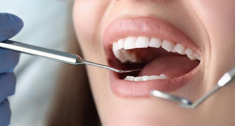 Продукты, вредящие зубам сильнее конфет