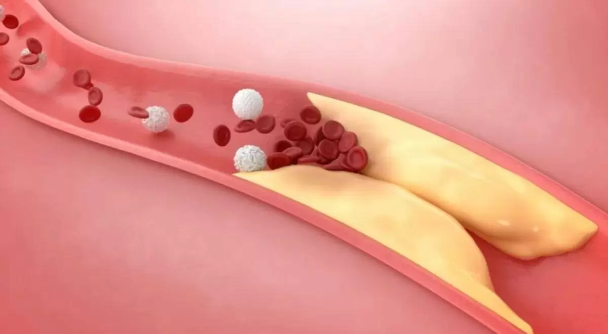 Как продукты помогают контролировать уровень холестерина и поддерживать здоровье сердца